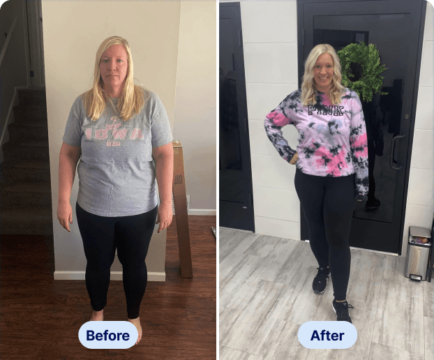 Before After - Susan