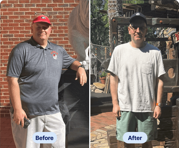 Before After - Chris
