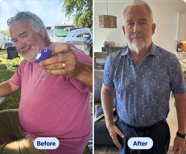 Before After - Tom