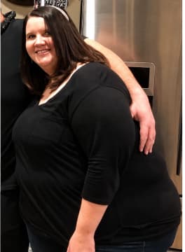 before picture of Carrisa